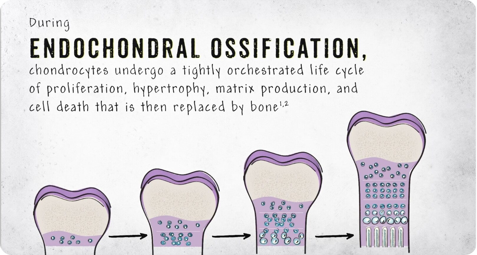 thumbnail of a video on fgfr3 signaling and endochondral ossification in skeletal dysplasia