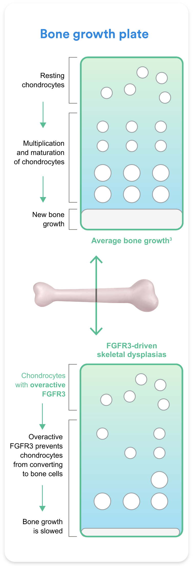 diagram comparing average bone growth to fgfr3-driven skeletal dysplasias, relevant to hypochondroplasia