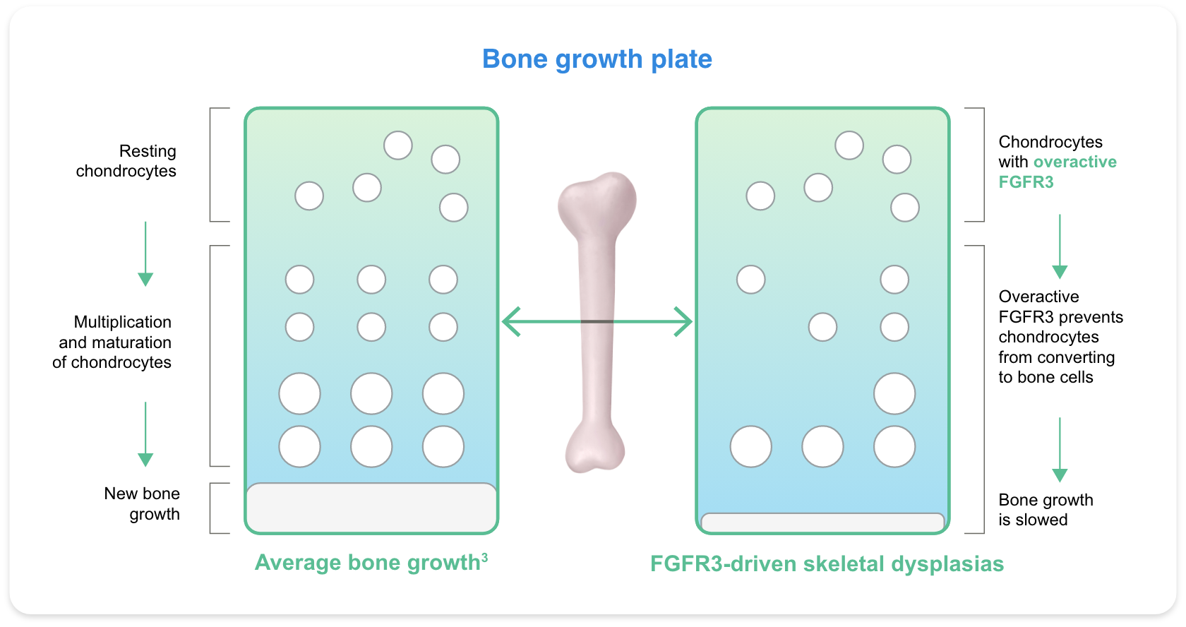 diagram comparing average bone growth to fgfr3-driven skeletal dysplasias, relevant to hypochondroplasia